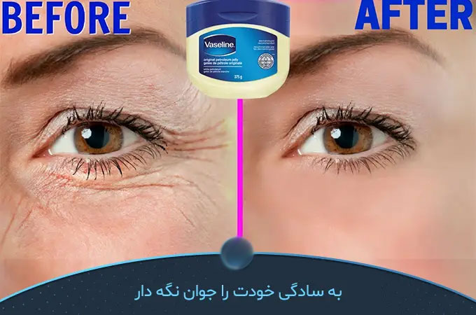 وازلین برای چروک زیر چشم چه تاثیر و عوارضی دارد؟