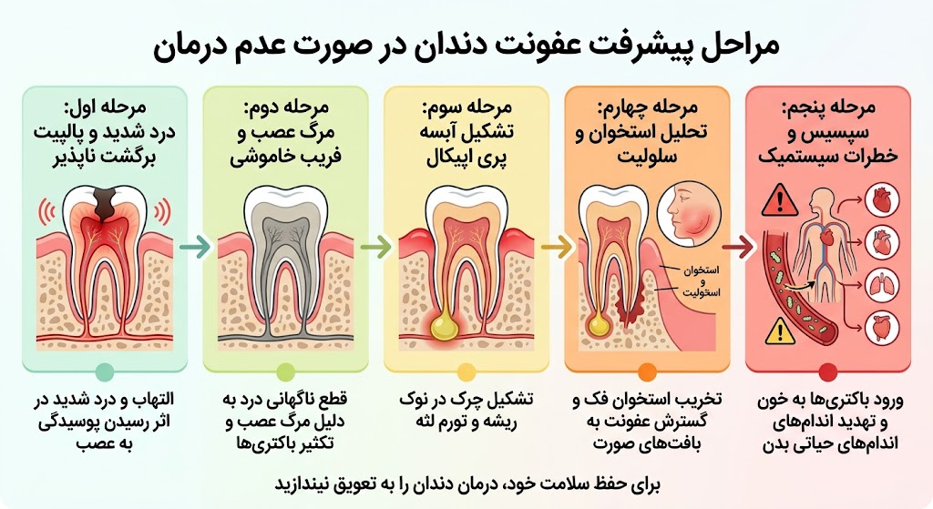 دندانپزشکی | ایمپلنت اگر دندان را عصب کشی نکنیم چه میشود